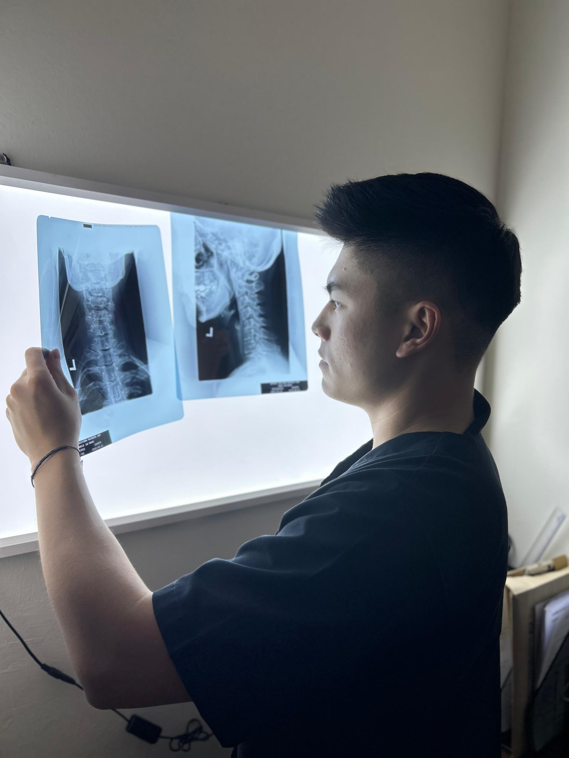 X-ray Analysis